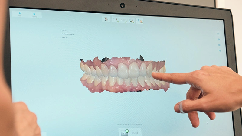 digital smile design 3 dimensions
